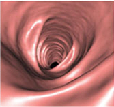 CT Colonoscopy image looking inside a normal colon