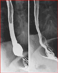 Esophagram